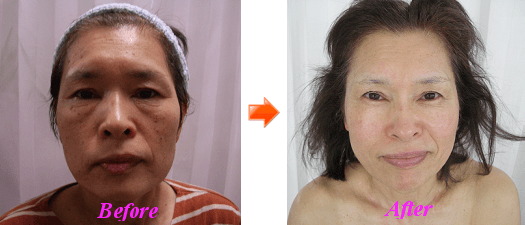 2Bバイオトリートメント｜上田でエステサロンをお探しなら Leeにお越し