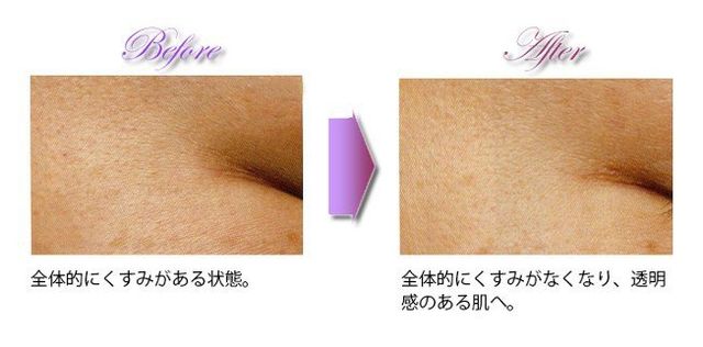 生コラーゲンコース｜上田でエステサロンをお探しなら Leeにお越し