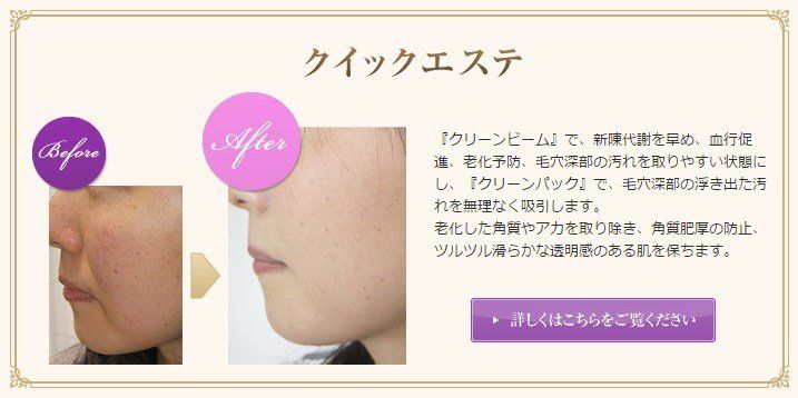 クイックエステ・詳しくはこちらをご覧ください