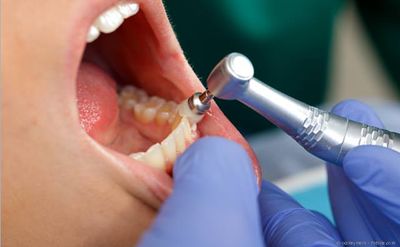 Gesunde Zähne mit regelmäßiger Prophylaxe. Professionelle Zahnreinigung (PZR)