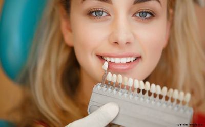 Weiße Zähne mit Bleaching (Zahnaufhellung): Ist sicher, wenn es der Zahnarzt macht