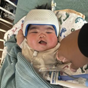 Baby in a medical crib wearing a cranial helmet, chubby cheeks, and tubes.