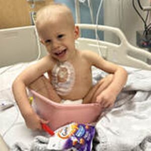 Smiling young child sitting in a pink bowl, wearing medical dressing, with snacks in bed.