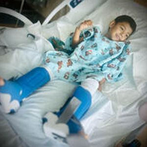 Young boy in hospital bed wearing a blue hospital gown and leg casts, smiling.