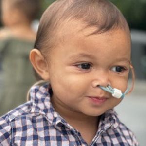 A young child with a nasal cannula smiles, wearing a plaid shirt.