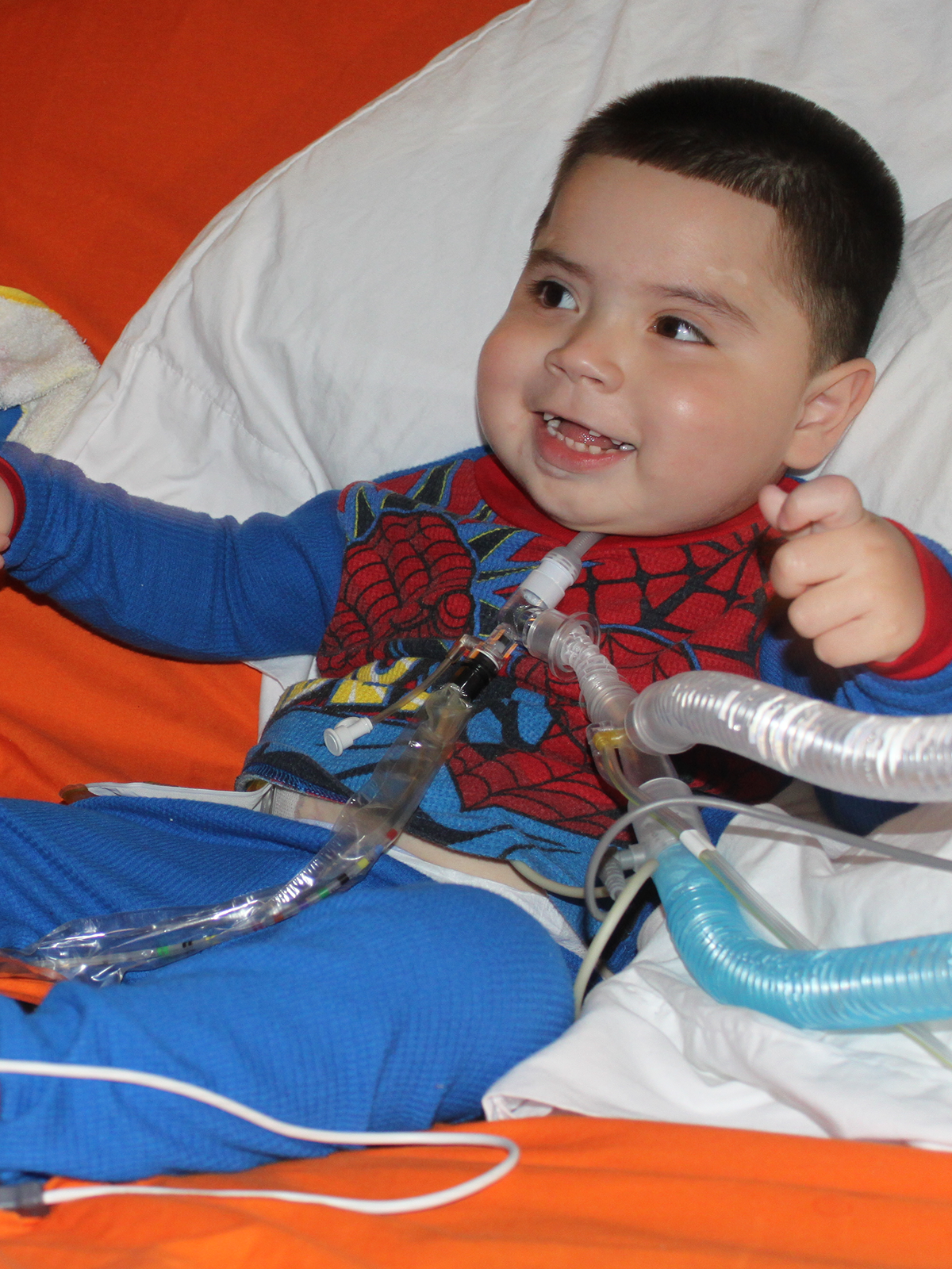 Young child in Spider-Man pajamas smiles while connected to medical tubes, lying in bed.