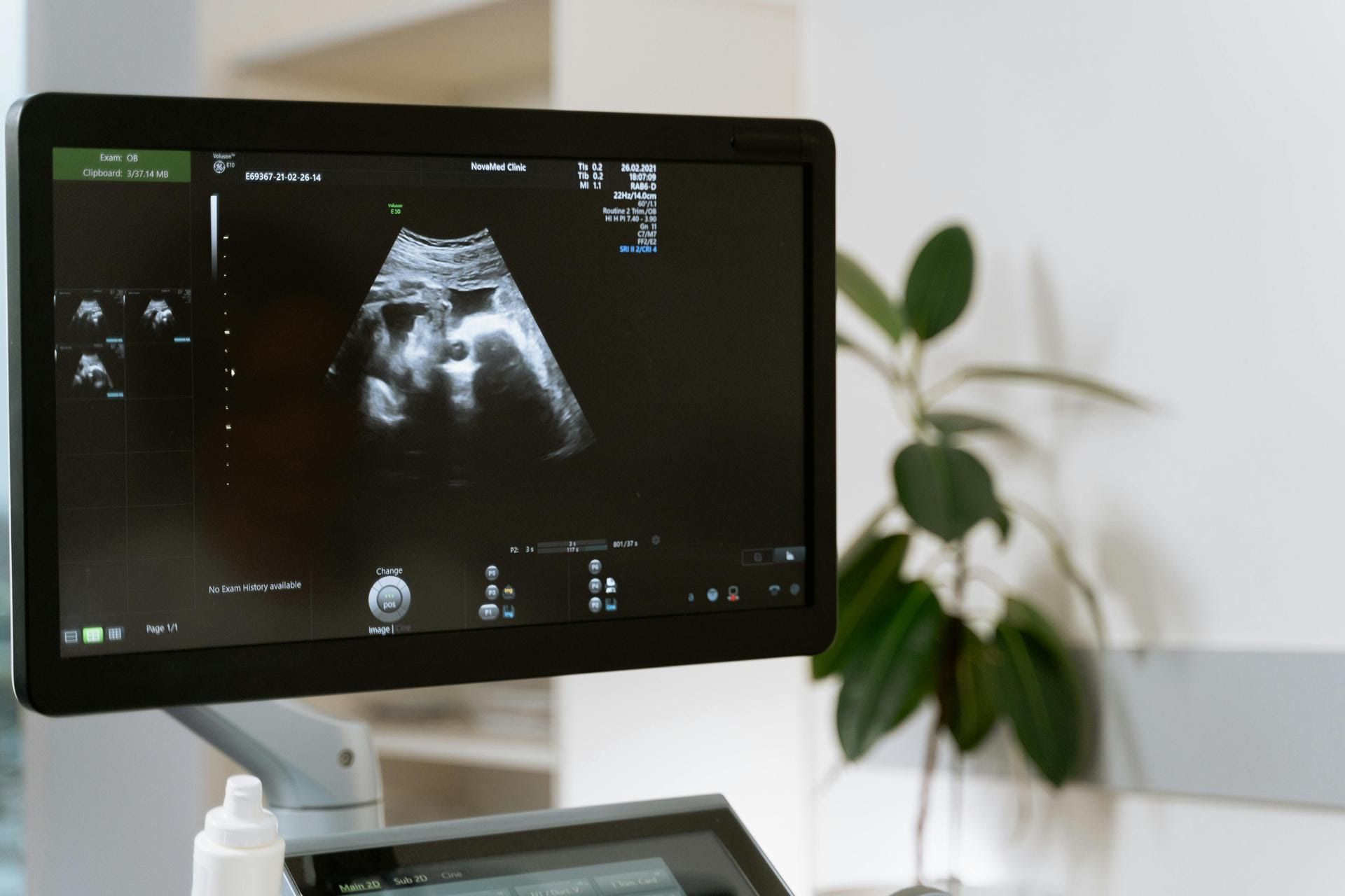 A computer monitor with a picture of a baby on it.