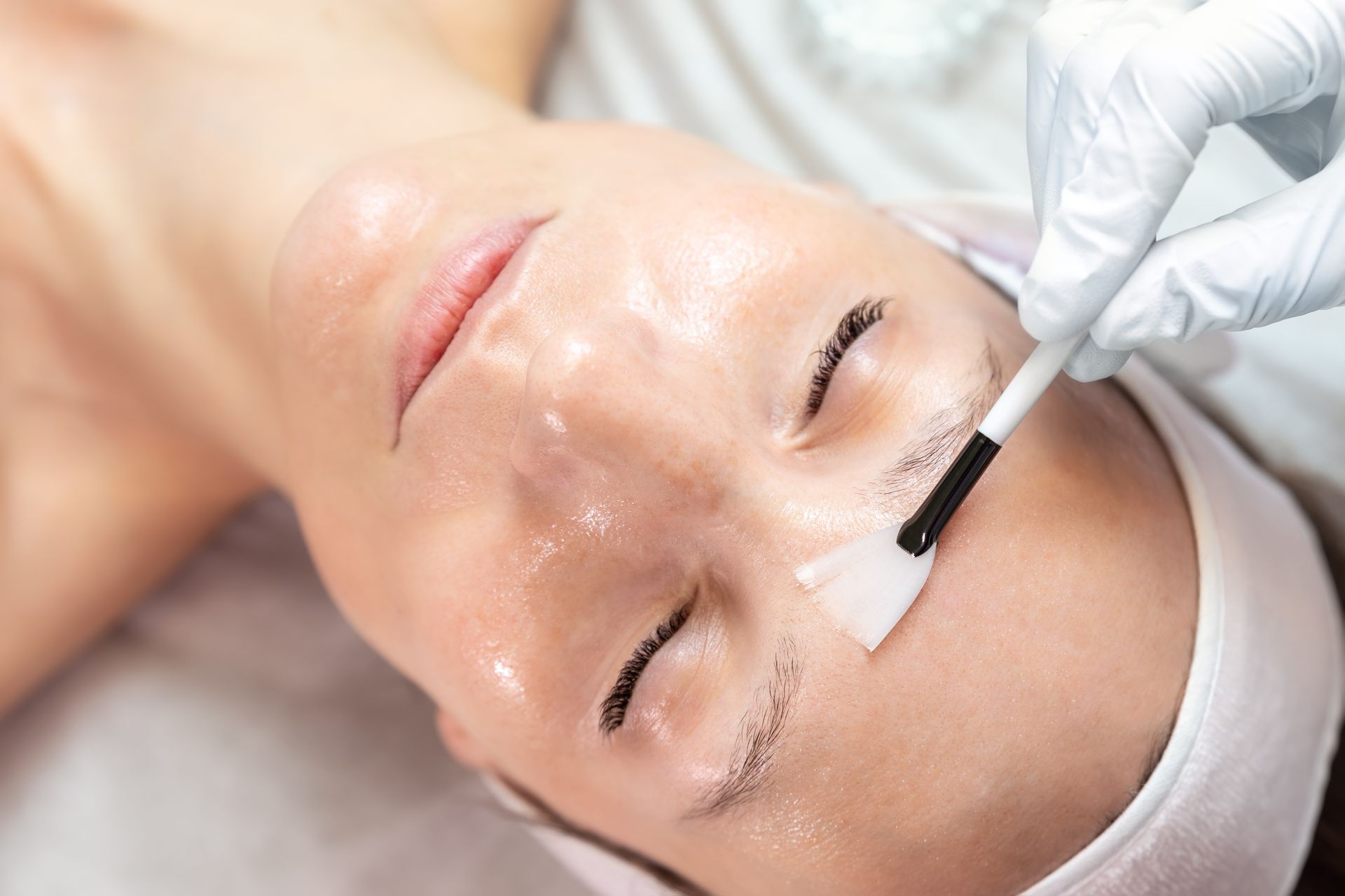 Woman receiving a facial peel, with a gloved hand applying a product to her forehead using a brush.