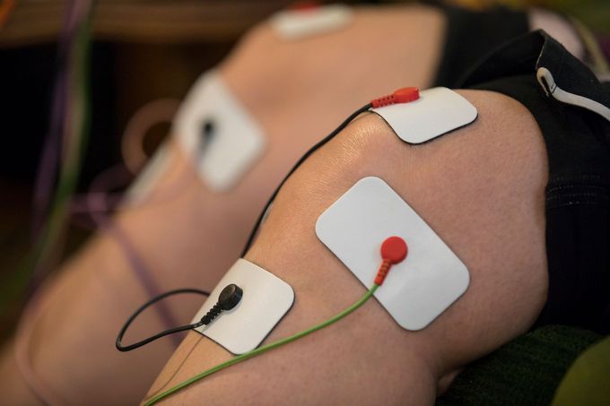 Ginocchia di una persona con elettrodi applicati per la terapia di stimolazione elettrica.