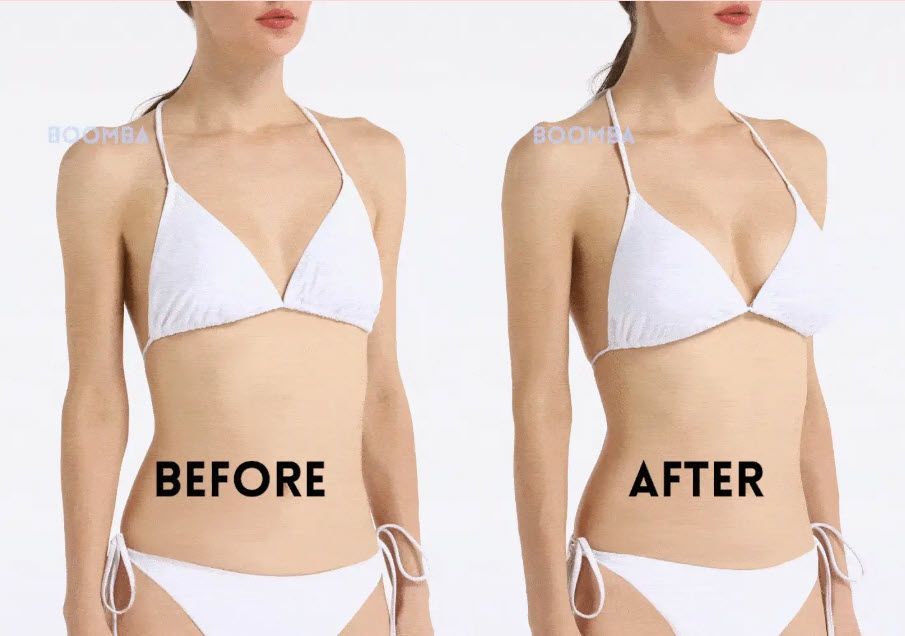 Comparison of a woman in a white bikini before and after breast enhancement. Comparison of a woman in a white bikini before and after breast enhancement.