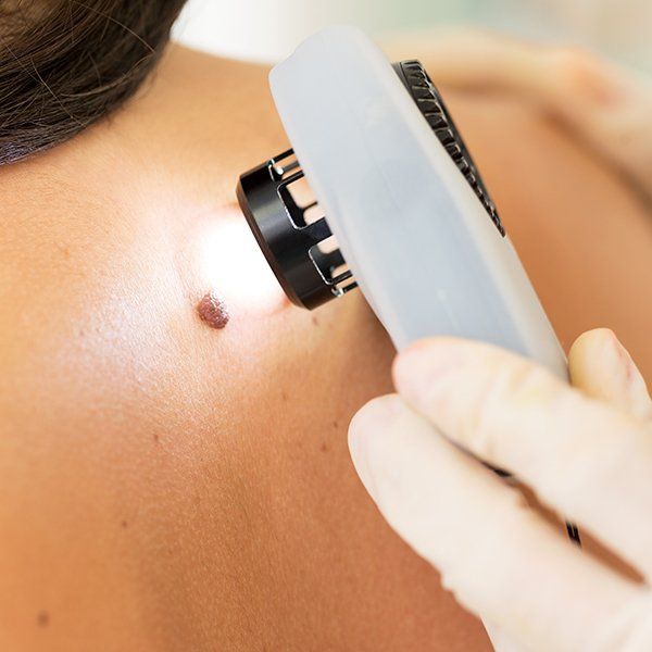 Skin Problem Treatment — Covington, GA — Dermatology Center of Newton-Rockdale