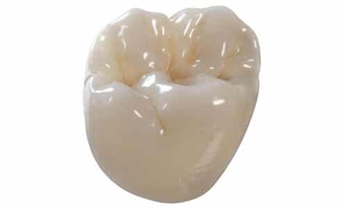 Cosmetic Dentistry | Lougheed Family Dental | Coquitlam Dentist