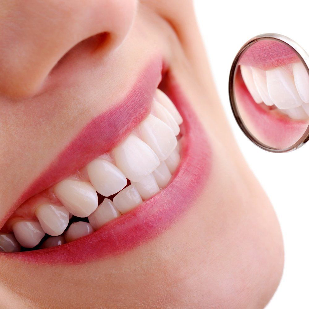 Woman With White Teeth — Sarasota, FL — Sterling Dental