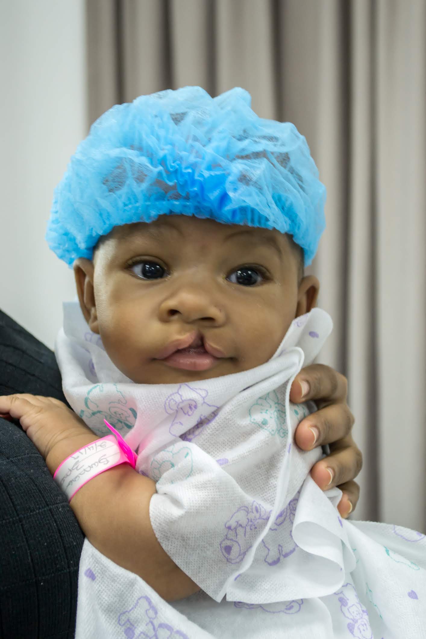 A baby with a cleft lip is wearing a blue hat.