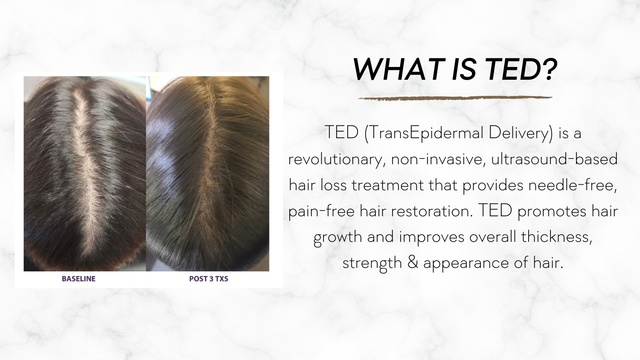 TED Hair Restoration | Needle‑Free Hair Growth