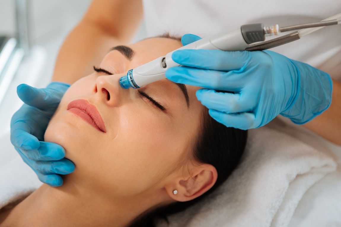 A woman is getting a micrneedling treatment at a beauty salon.