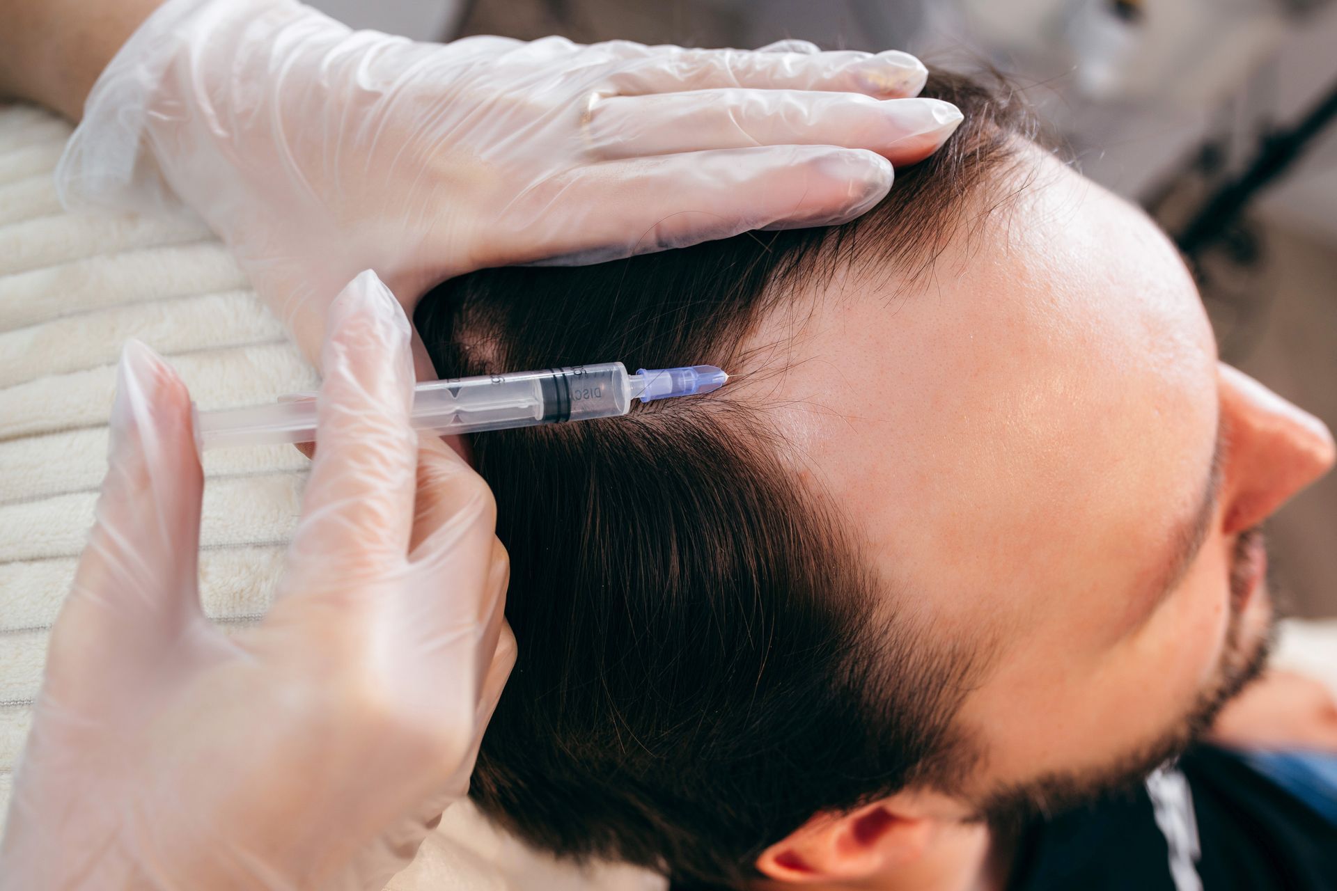 A man is getting an injection in his head with a syringe.