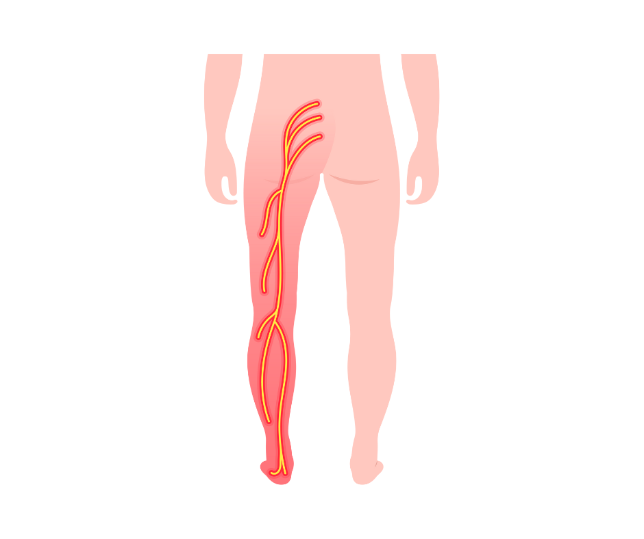 Illustrazione di una postura corretta per prevenire la lombosciatalgia.