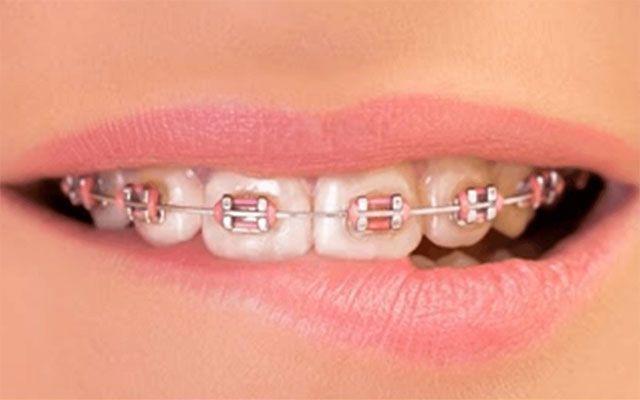 DR. MARCO TULIO CÁRDENAS - Ortodoncia