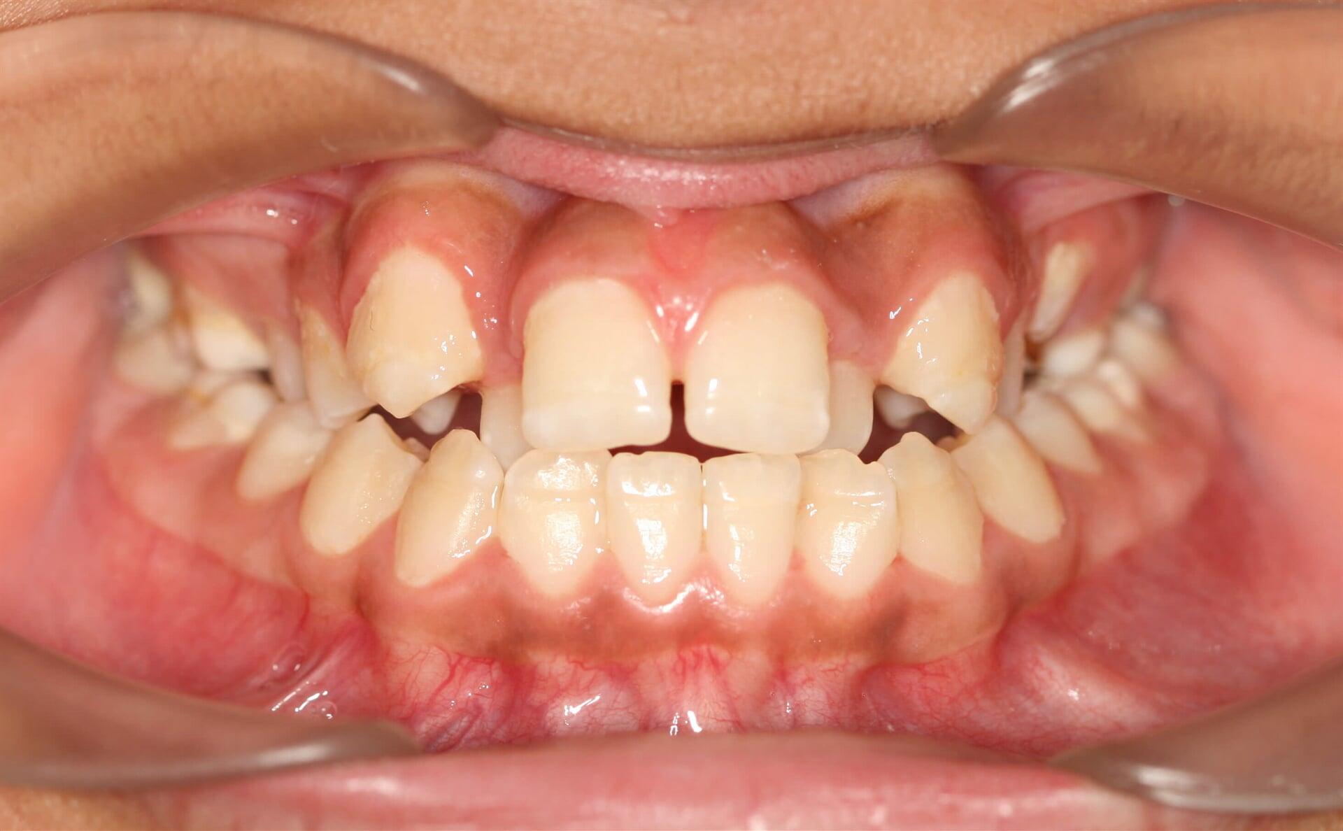 DR. MARCO TULIO CÁRDENAS - Antes