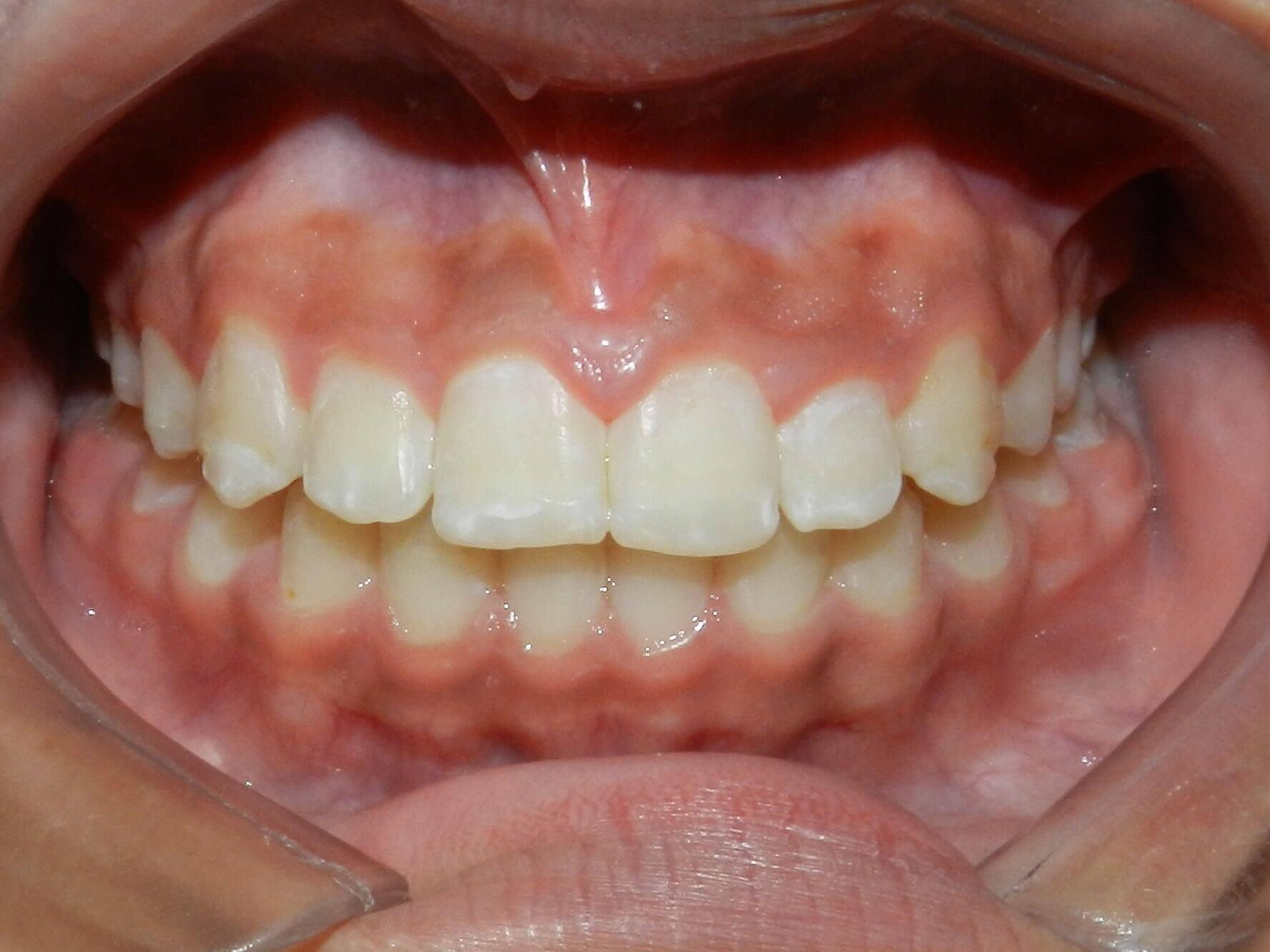 DR. MARCO TULIO CÁRDENAS - Finales