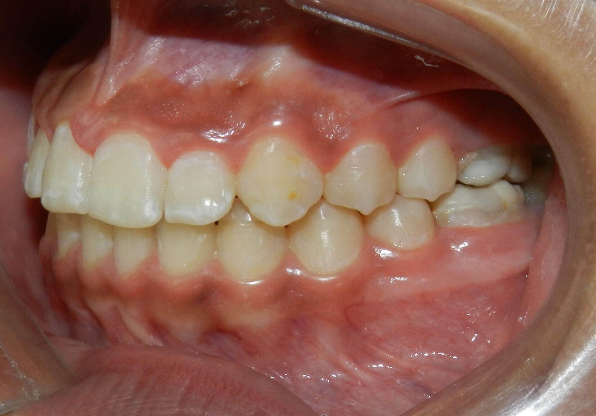 DR. MARCO TULIO CÁRDENAS - Después