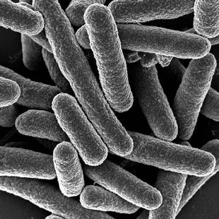 A black and white photo of bacteria under a microscope.