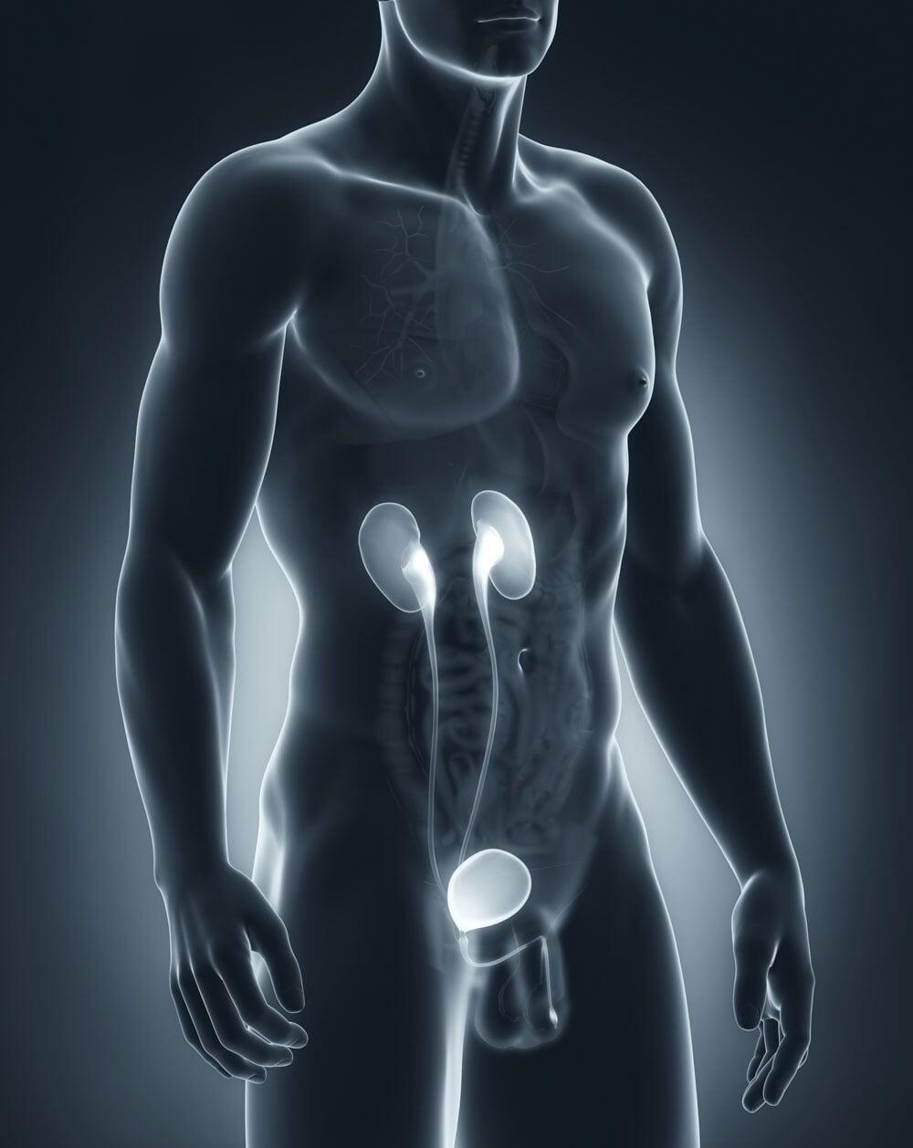 DRA. MARÍA FRANCISCA PADILLA ESPINOSA - Piedras en el riñón