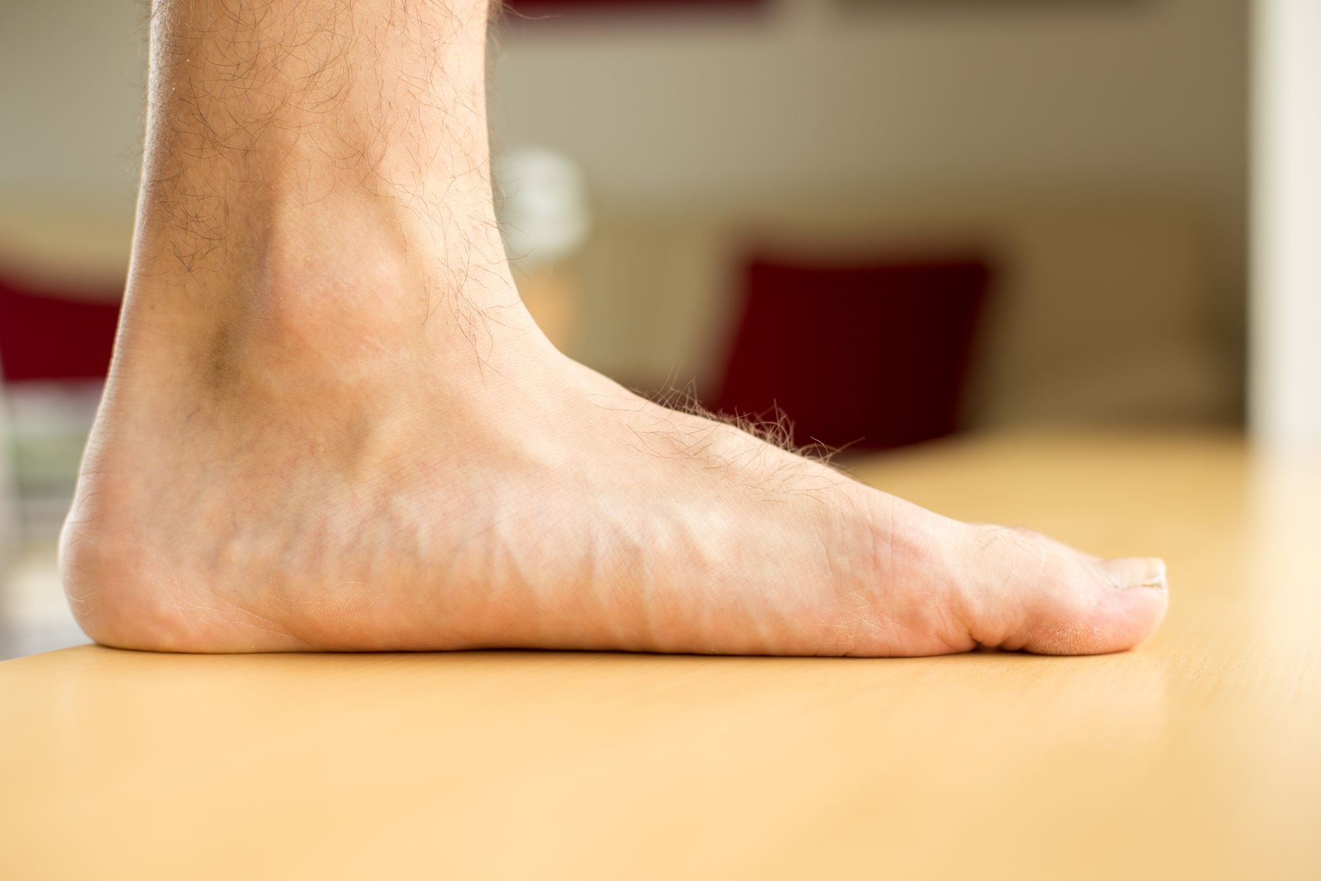 Bare foot showing flat arch.