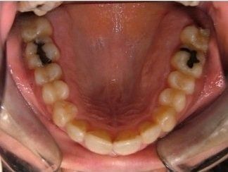 arcata dentale da curare