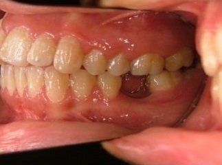 denti da curare con ortodonzia