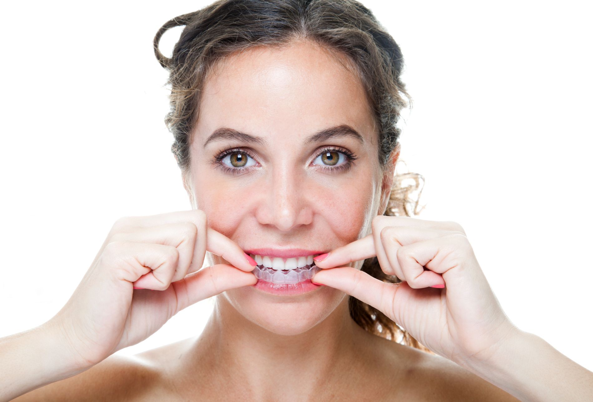 Invisalign