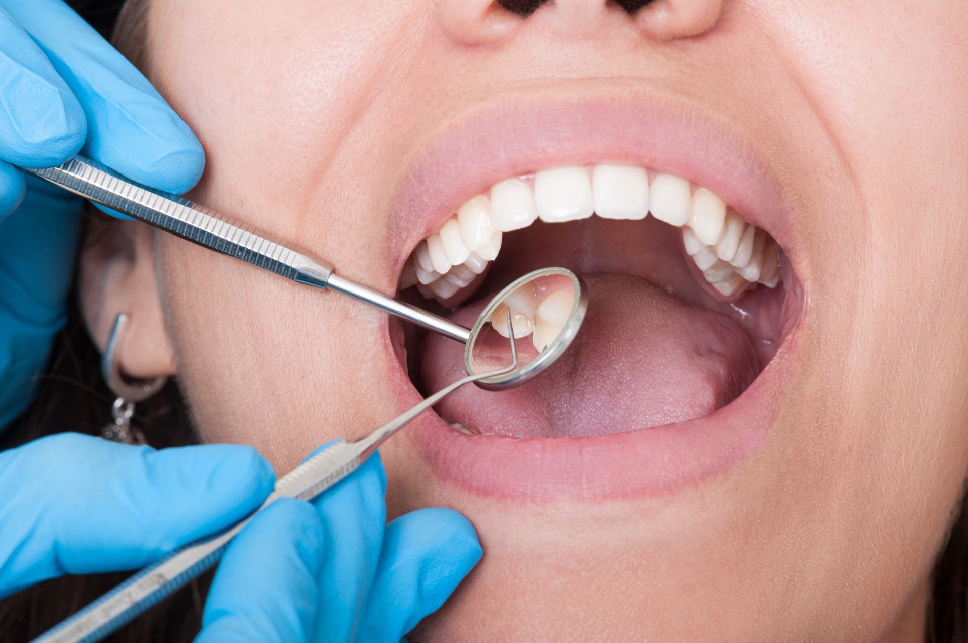 Dentist examining a patient's healthy smile