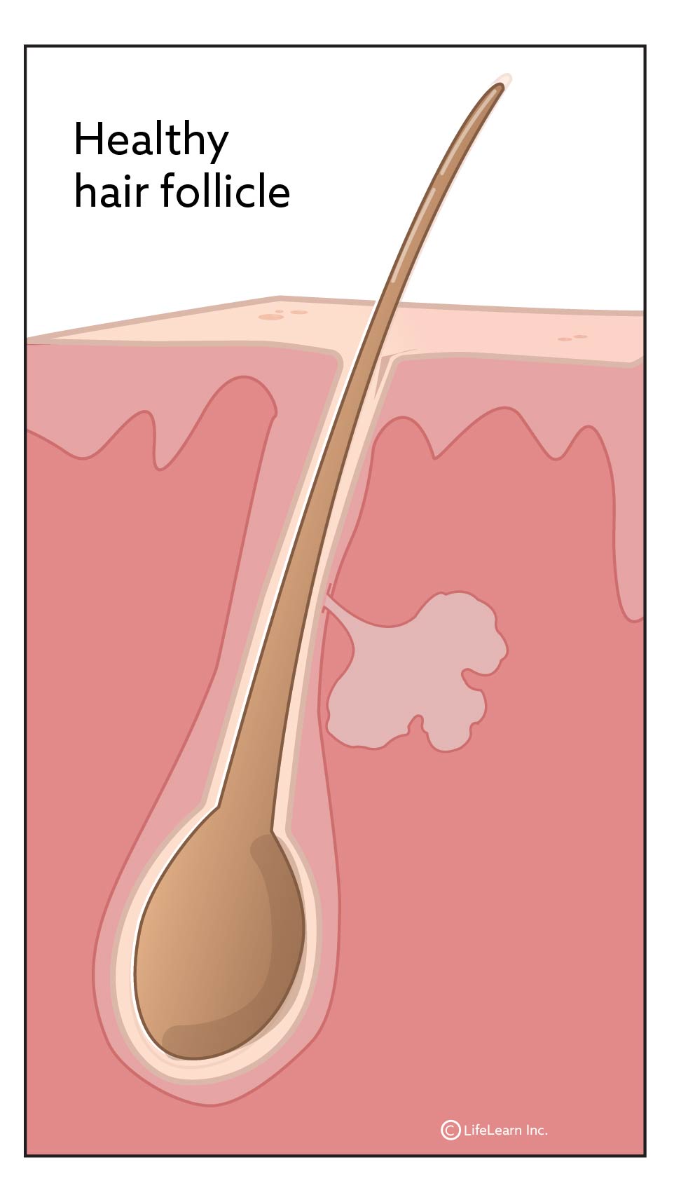 how do i get rid of my dogs chin acne