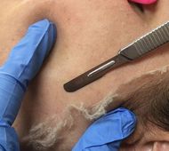 Facial Treatment Icon