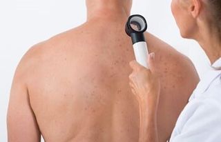 Skin Cancer Treatment — Skin Being Checked in Slidell, LA