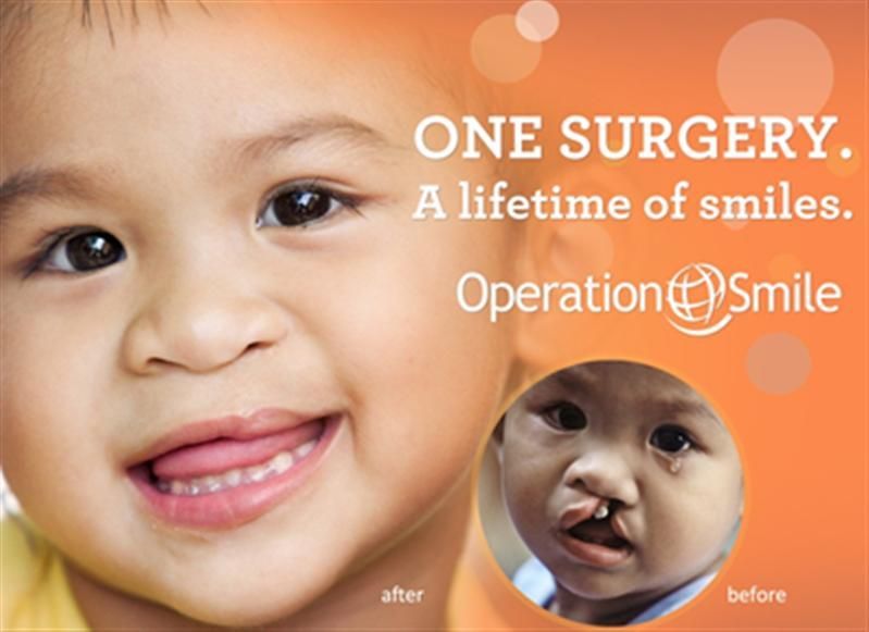 An advertisement for one surgery a lifetime of smiles An advertisement for one surgery a lifetime of smiles