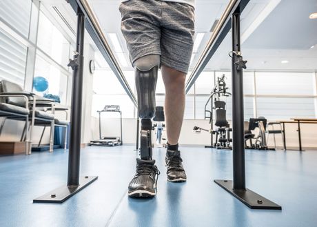 Man with prosthetic leg — Fayetteville, NC — Total Rehab Orthotics & Prosthetics