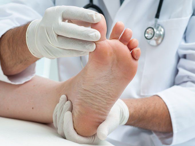 Tinia pedis or Athlete's foot