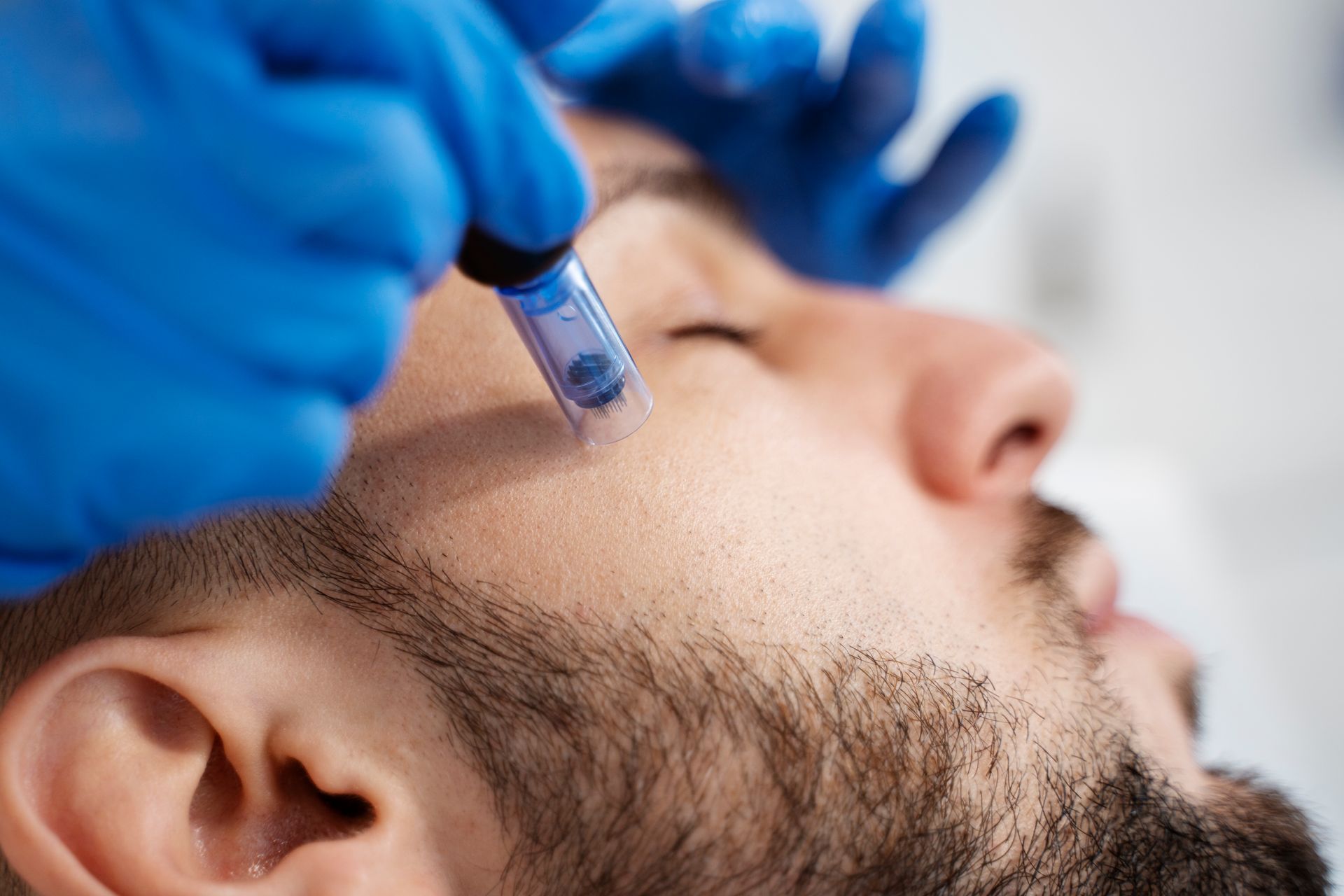 A man with a beard is getting a treatment on his face.