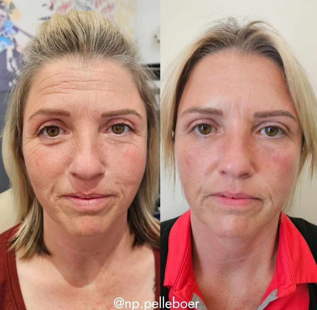 A before and after photo of a woman 's face