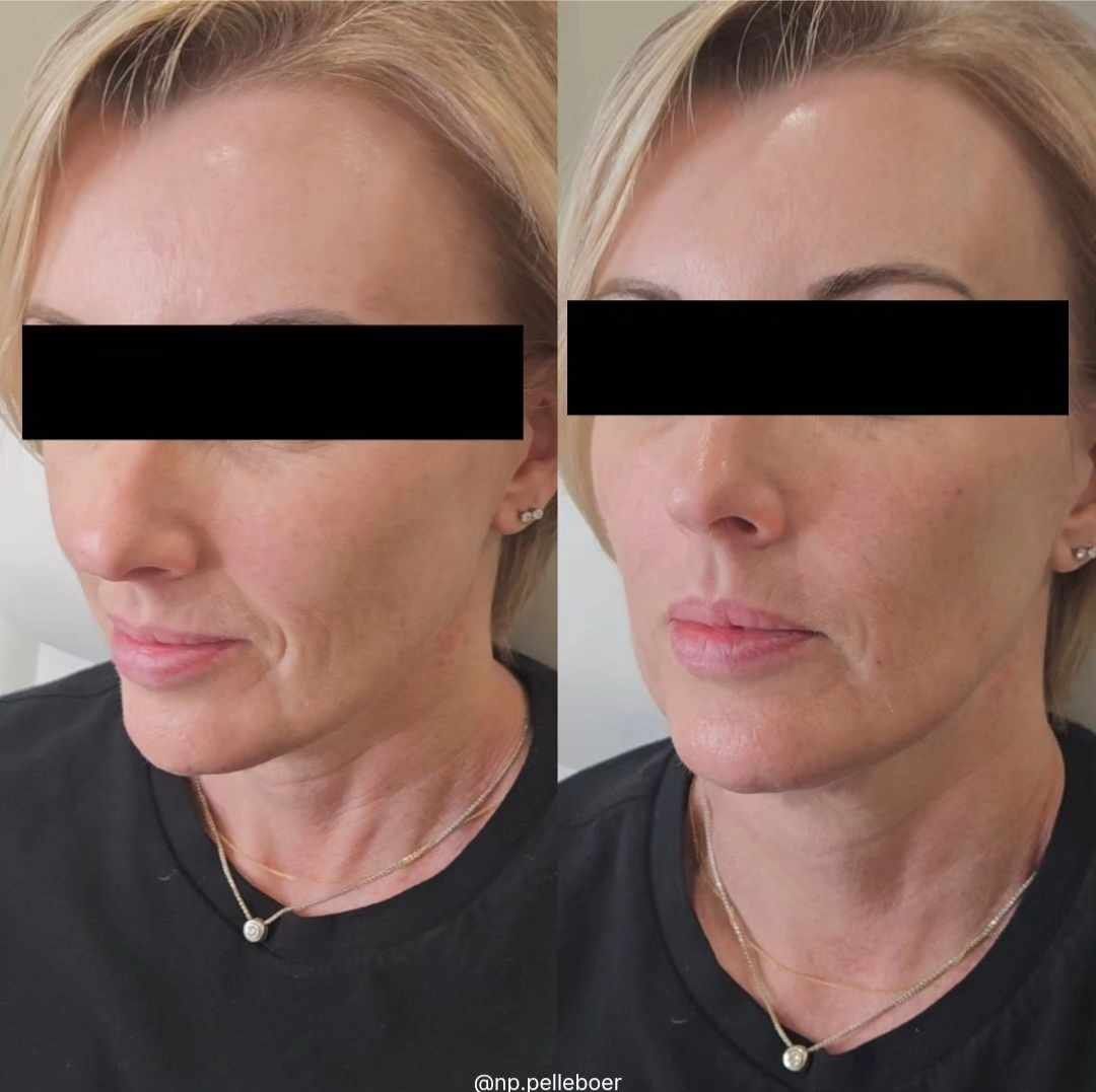 A before and after photo of a woman with her eyes covered