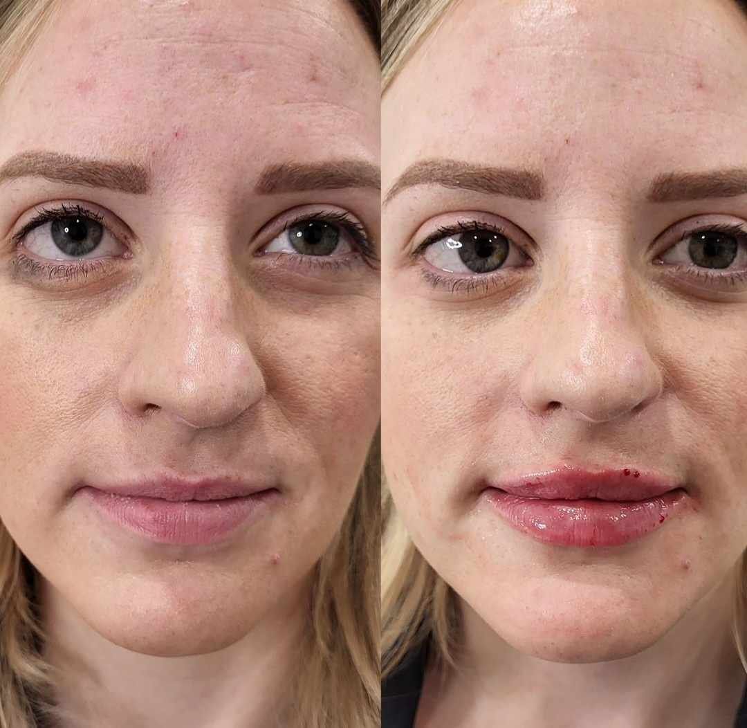 A before and after photo of a woman 's face