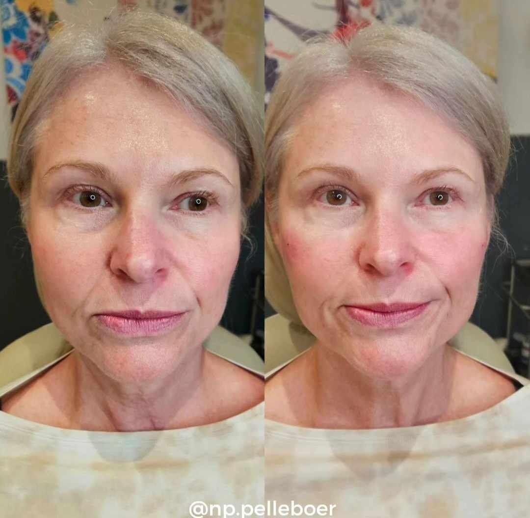 A before and after photo of a woman 's face