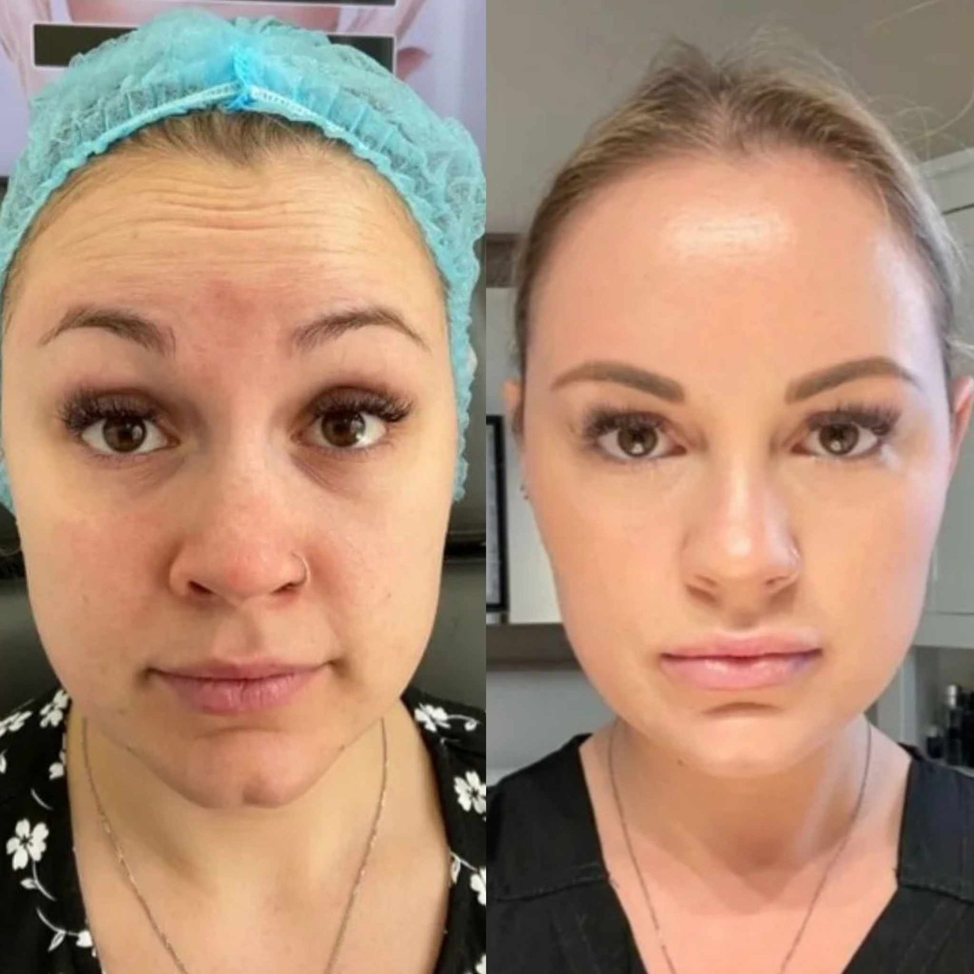 A before and after photo of a woman 's face