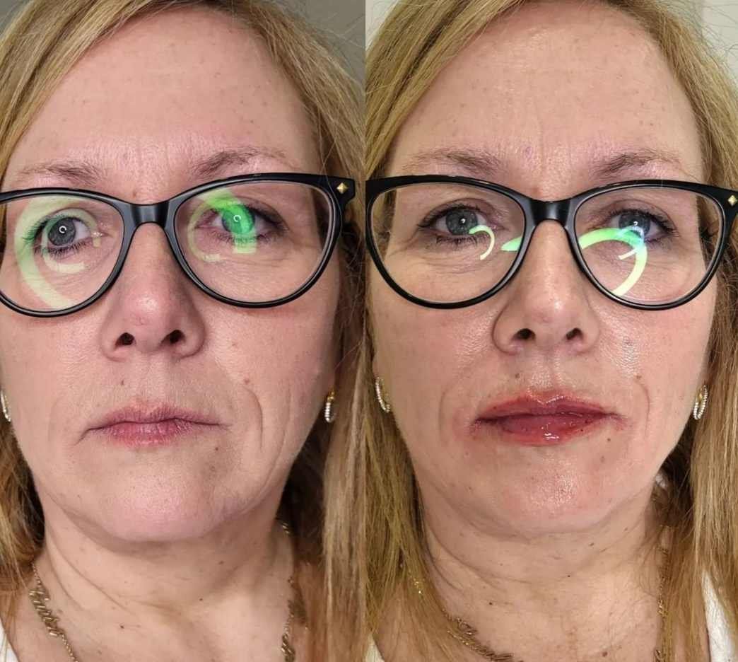 Two pictures of a woman wearing glasses and a white shirt