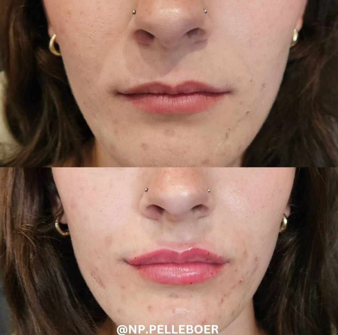 A before and after photo of a woman 's face