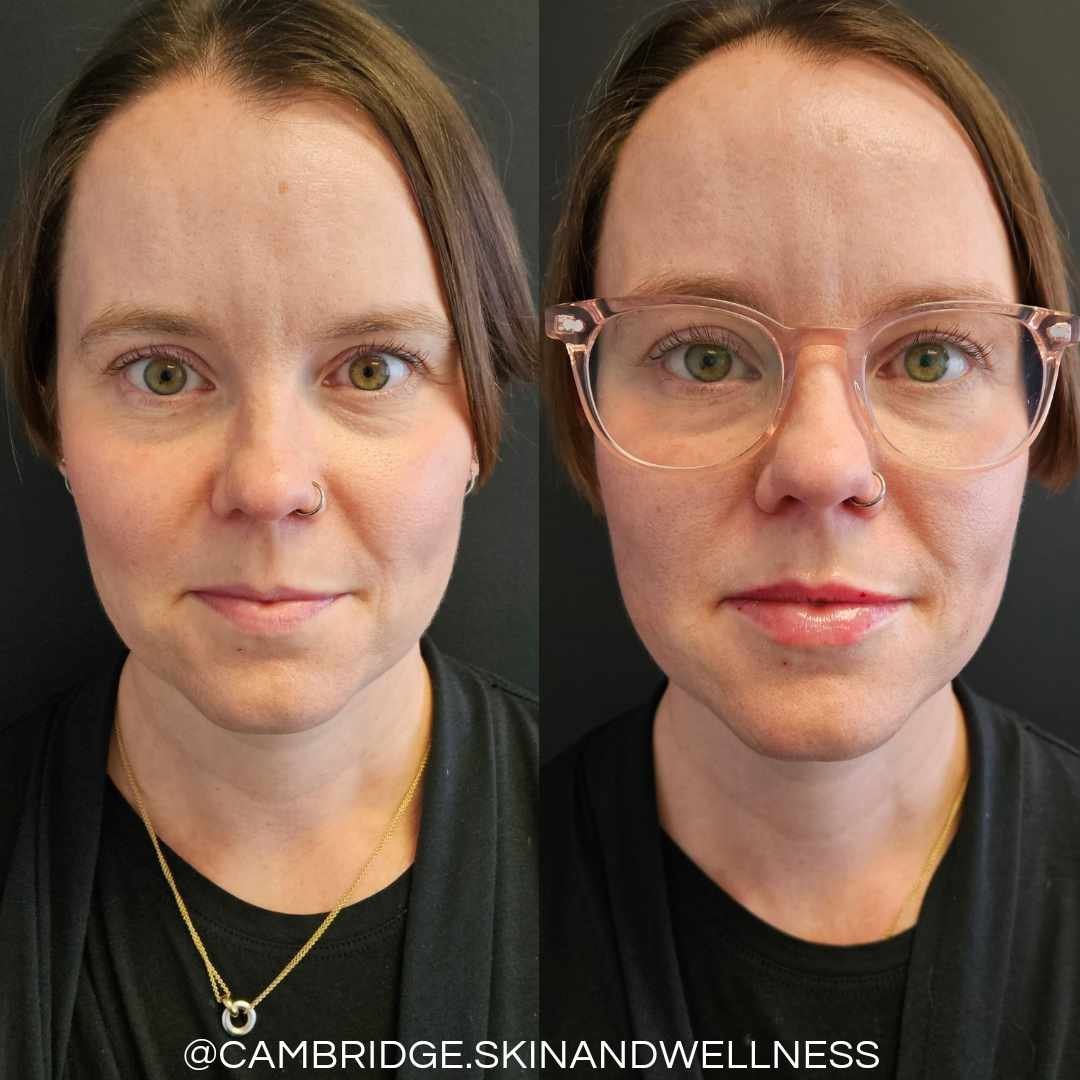 A before and after photo of a woman wearing glasses.