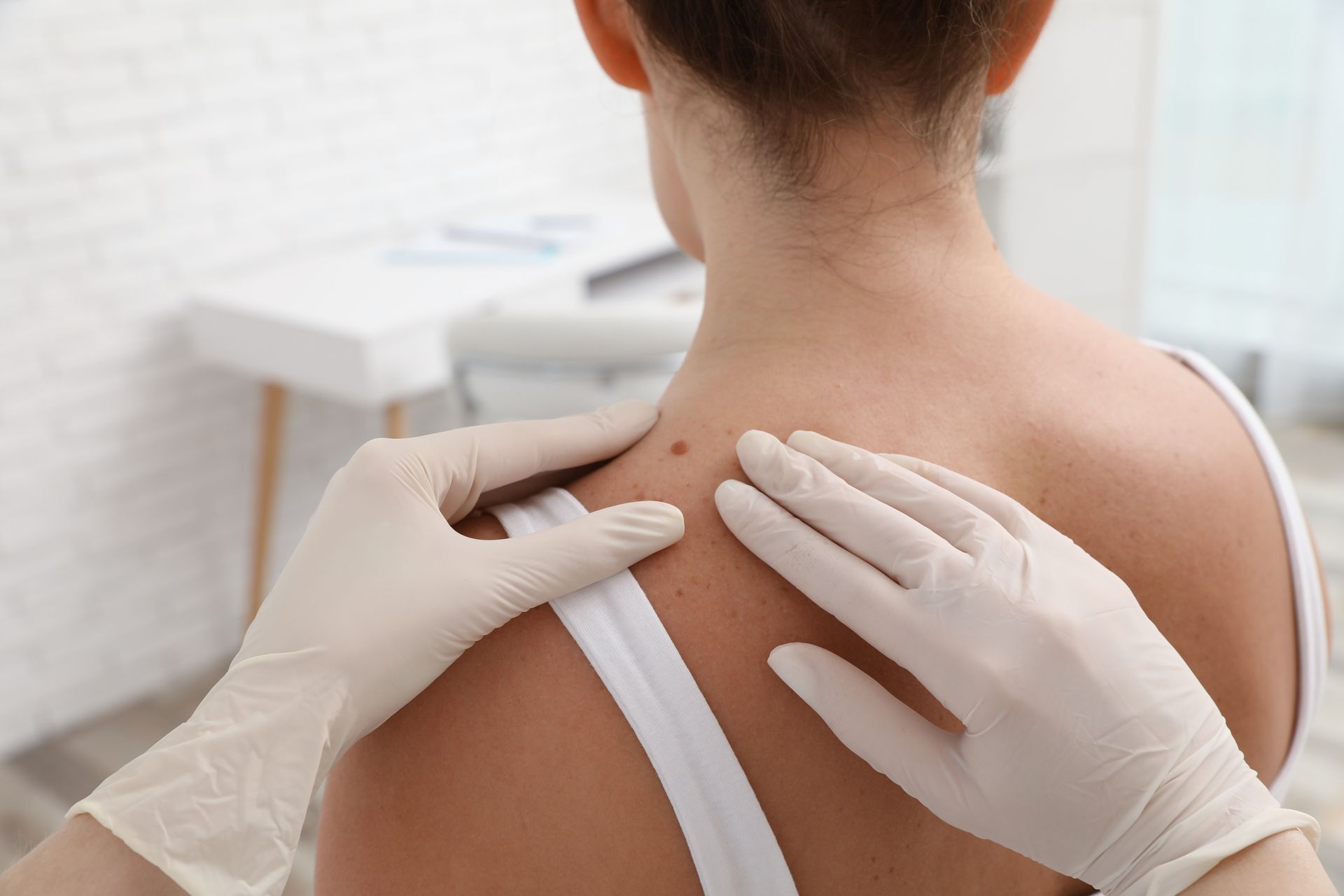 A doctor is examining a woman 's back for a mole.