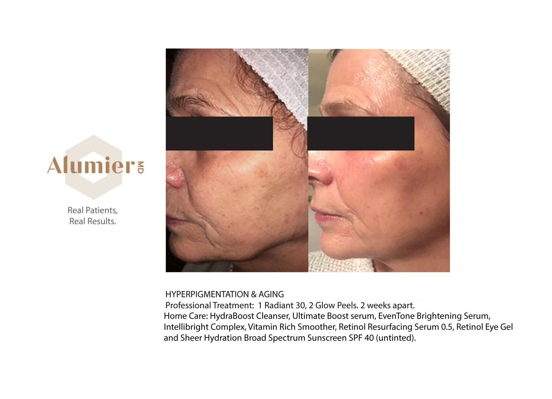 A before and after photo of a woman 's face.